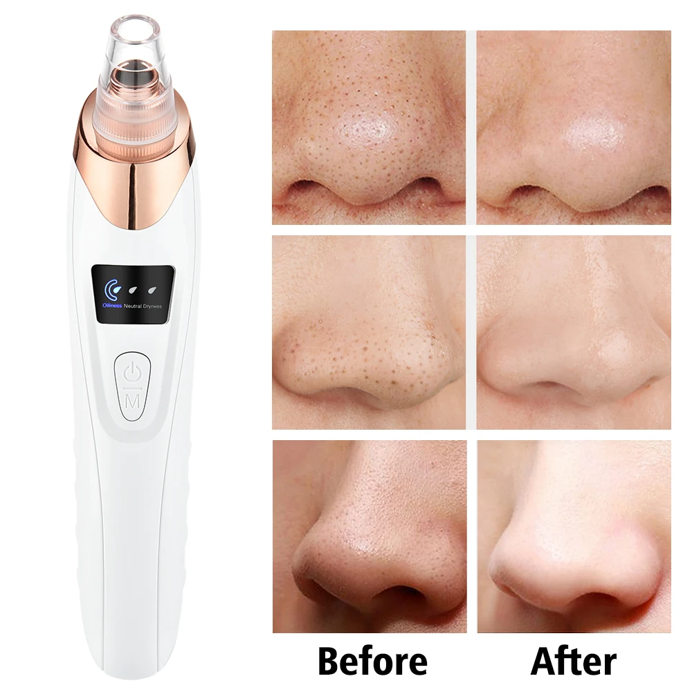 Blackhead Remover Vacuum Acne Cleaner Black Spots Removal Cleaner Machine