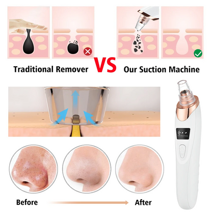 Blackhead Remover Vacuum Acne Cleaner Black Spots Removal Cleaner Machine